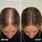 Dr. Groot Hair Growth Serum