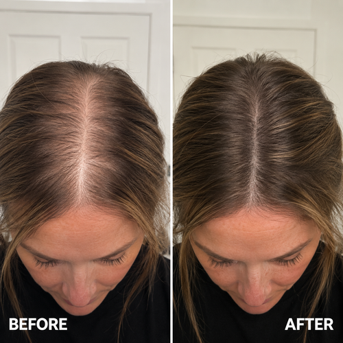 Dr. Groot Hair Growth Serum